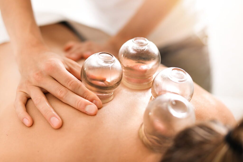 cupping massage